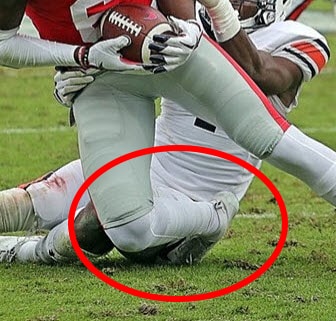 football player getting a high ankle sprain