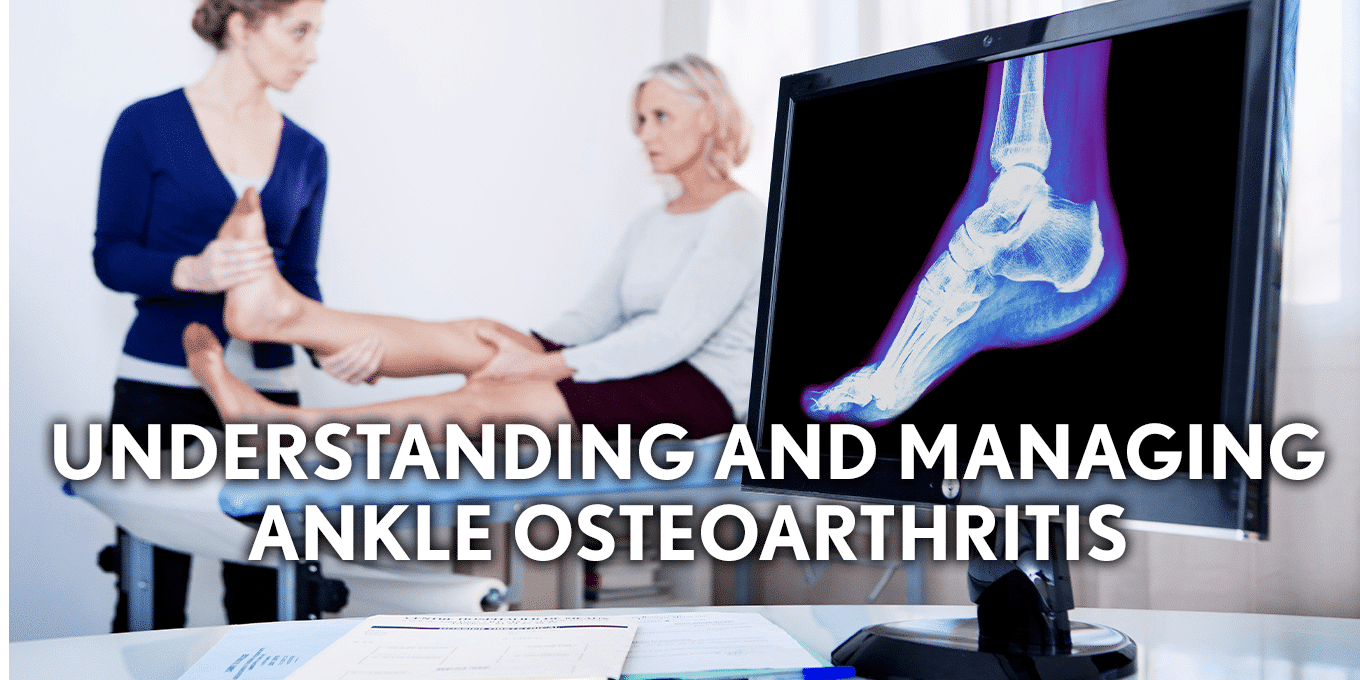 Understanding and Managing Ankle Osteoarthritis