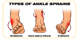 ultra ankle-ankle sprains